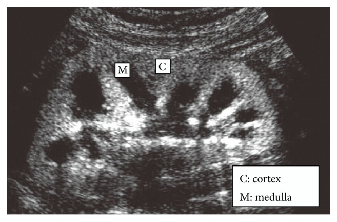 Future of the Renal Biopsy: Time to Change the Conventional Modality Using Nanotechnology.