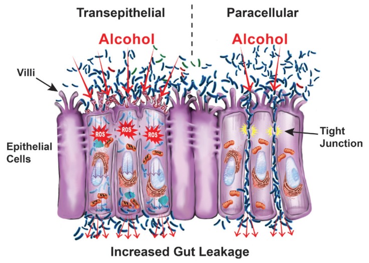 Alcohol and Gut-Derived Inflammation.