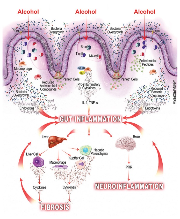 Alcohol and Gut-Derived Inflammation.