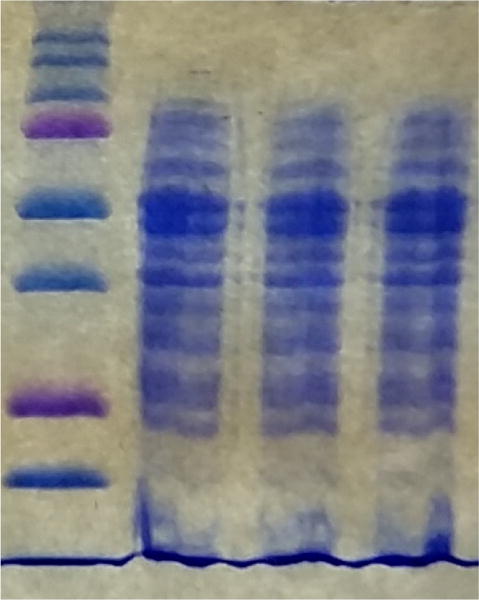 Proteomic Approach for Extracting Cytoplasmic Proteins from <i>Streptococcus sanguinis</i> using Mass Spectrometry.