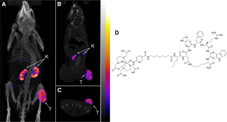 Molecular Imaging and Radionuclide Therapy of Melanoma Targeting the Melanocortin 1 Receptor.