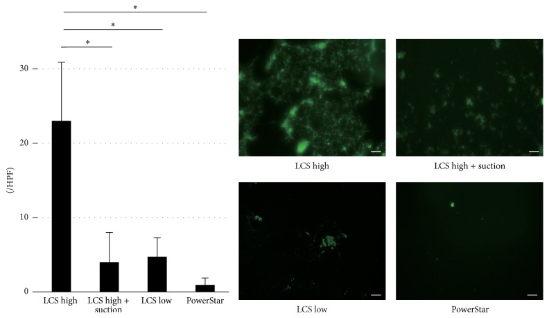 Viability of Airborne Tumor Cells during Excision by Ultrasonic Device.