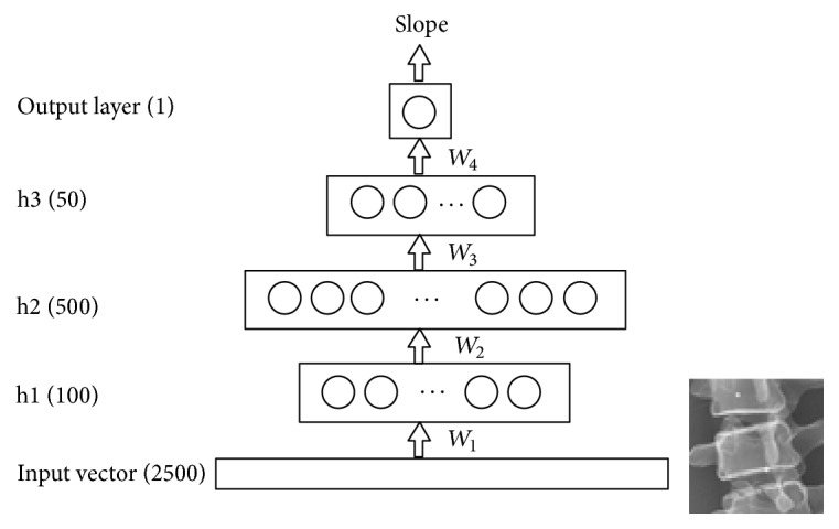 Computer-Aided Cobb Measurement Based on Automatic Detection of Vertebral Slopes Using Deep Neural Network.