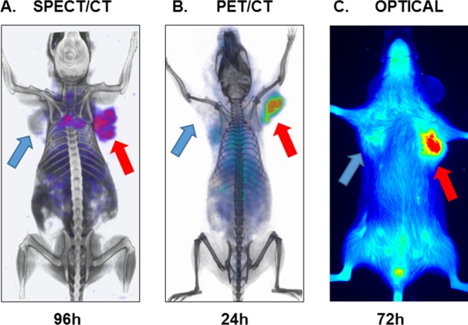 Noninvasive Imaging of Immune Checkpoint Ligand PD-L1 in Tumors and Metastases for Guiding Immunotherapy.