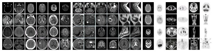 Medical Image Fusion Based on Feature Extraction and Sparse Representation.