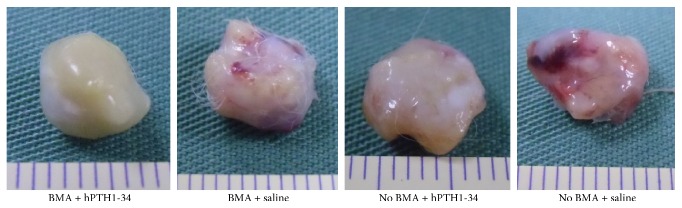 Feasibility and Efficacy of Autologous Bone Marrow Aspirate Transplantation Combined with Human Parathyroid Hormone 1-34 Administration to Treat Osteonecrosis in a Rabbit Model.