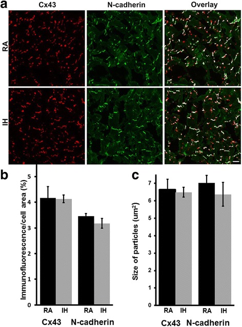 Intermittent hypoxia causes NOX2-dependent remodeling of atrial connexins.