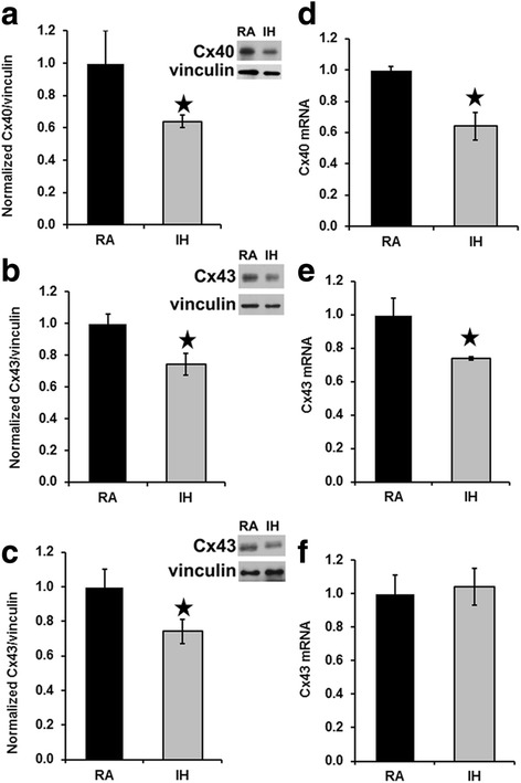 Intermittent hypoxia causes NOX2-dependent remodeling of atrial connexins.