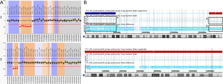 Molecular genetic techniques for gains and losses of genomic material in a case of acute myeloid leukemia