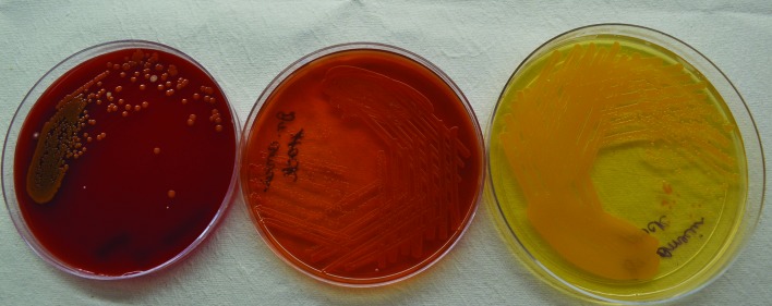 Simultaneous isolation of <i>Chryseobacterium gleum</i> from bloodstream and respiratory tract: first case report from India.