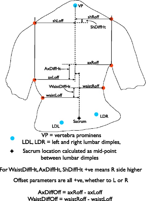 The effects of scoliosis and subsequent surgery on the shape of the torso.