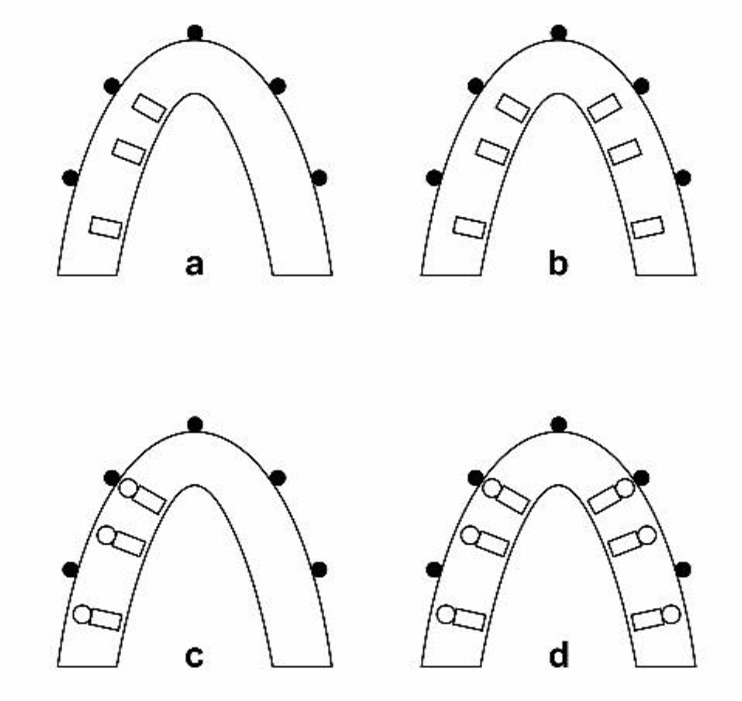 Effect of Dental Implant Metal Artifacts on Accuracy of Linear Measurements by Two Cone-Beam Computed Tomography Systems Before and After Crown Restoration.