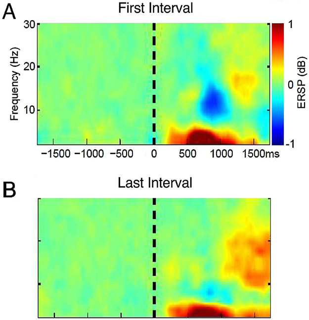 Vigilance behaviors and EEG activity in sustained attention may affect acute pain.