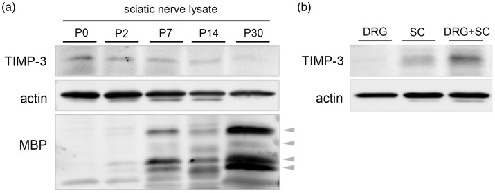 Tissue Inhibitor of Metalloproteinase-3 Promotes Schwann Cell Myelination.