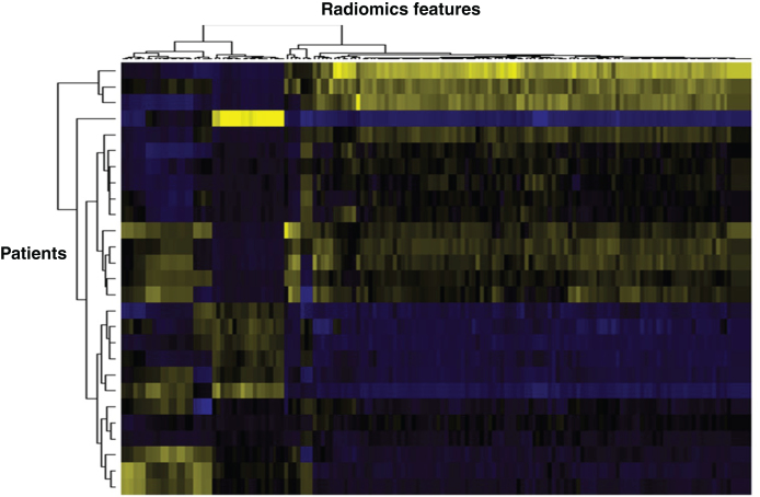 Imaging Response of Antiangiogenic and Immune-Oncology Drugs in Metastatic Renal Cell Carcinoma (mRCC): Current Status and Future Challenges.