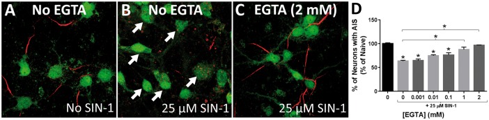 Oxidative Stress Induces Disruption of the Axon Initial Segment.