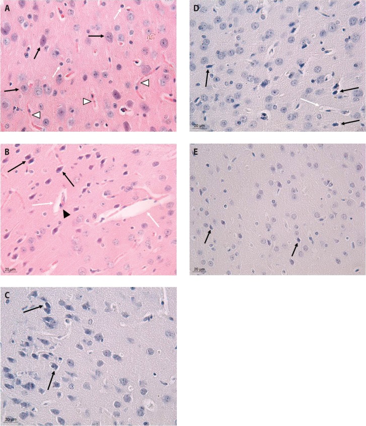 Comparative effects of meso-2,3- dimercaptosuccinic acid, monensin, and salinomycin on cadmium-induced brain dysfunction in cadmium-intoxicated mice.