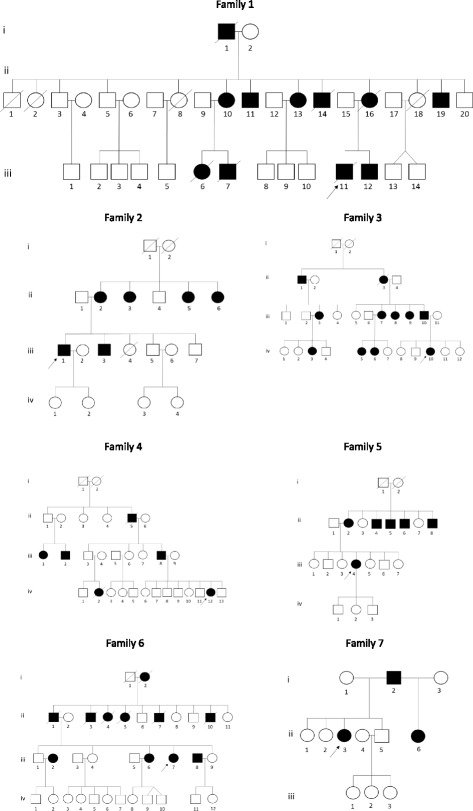 Clinical and genetic analysis of spinocerebellar ataxia type 7 (SCA7) in Zambian families.