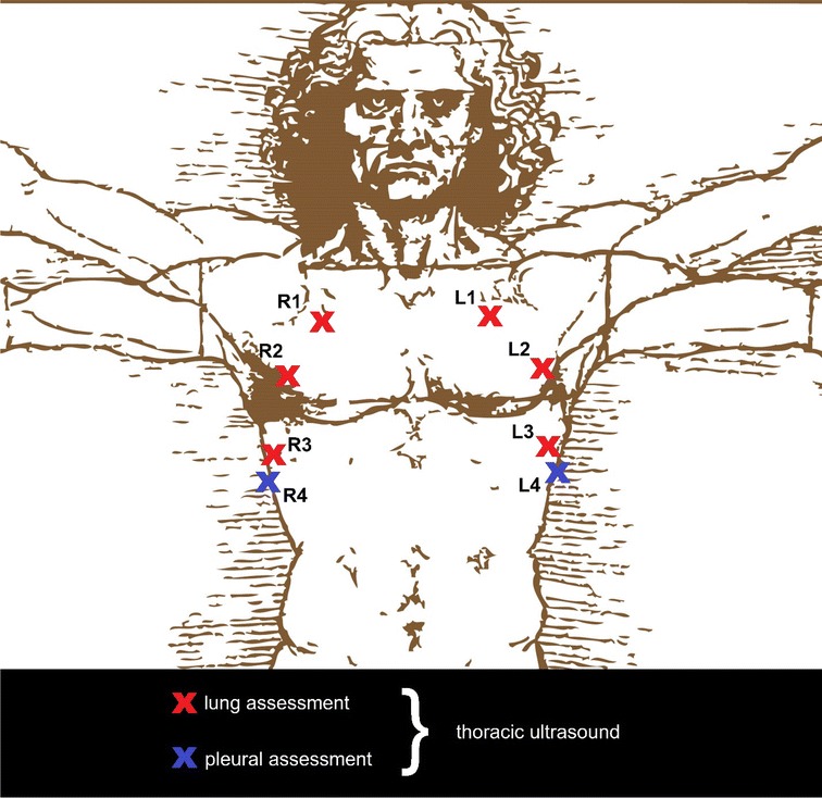 The Assessment of Competency in Thoracic Sonography (ACTS) scale: validation of a tool for point-of-care ultrasound.