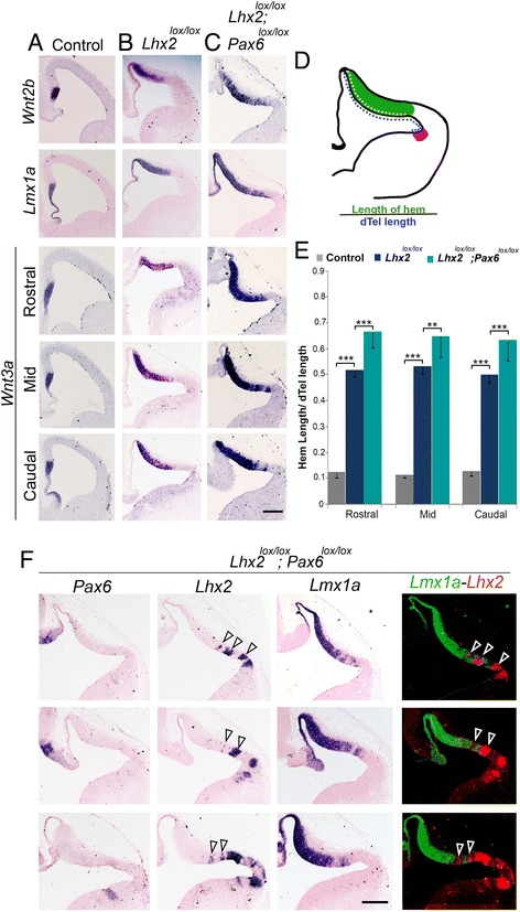 Novel functions of LHX2 and PAX6 in the developing telencephalon revealed upon combined loss of both genes.