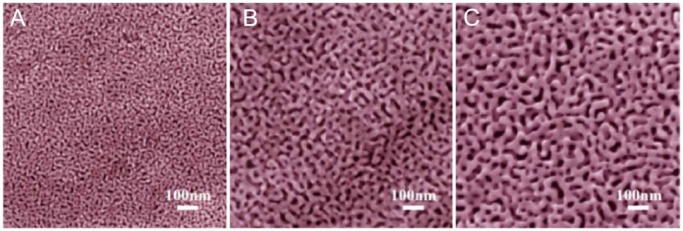 Enzyme Immobilization on Nanoporous Gold: A Review.