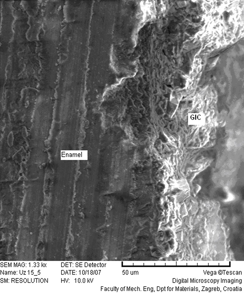 Thermo-cured glass ionomer cements in restorative dentistry.