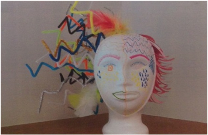 Development and use of the art therapy seizure assessment sculpture on an inpatient epilepsy monitoring unit