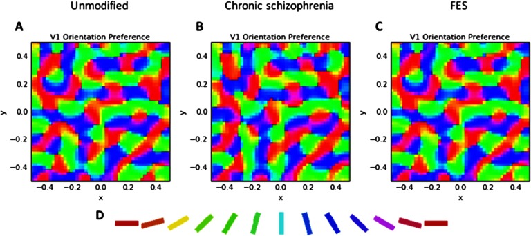 Computational Modeling of Contrast Sensitivity and Orientation Tuning in First-Episode and Chronic Schizophrenia.