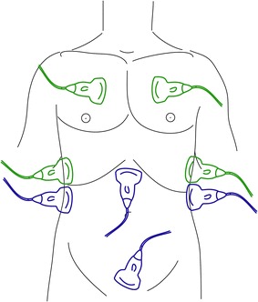 Ultrasonography in trauma: a nation-wide cross-sectional investigation.