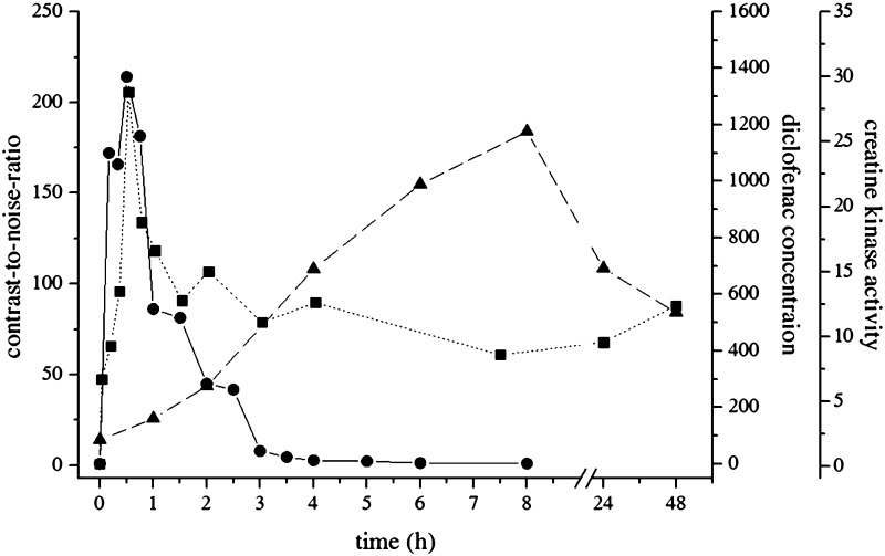 Muscle Injury After Intramuscular Administration of Diclofenac: A Case Report Supported by Magnetic Resonance Imaging.