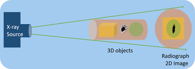 Cone beam computed tomography: basics and applications in dentistry.