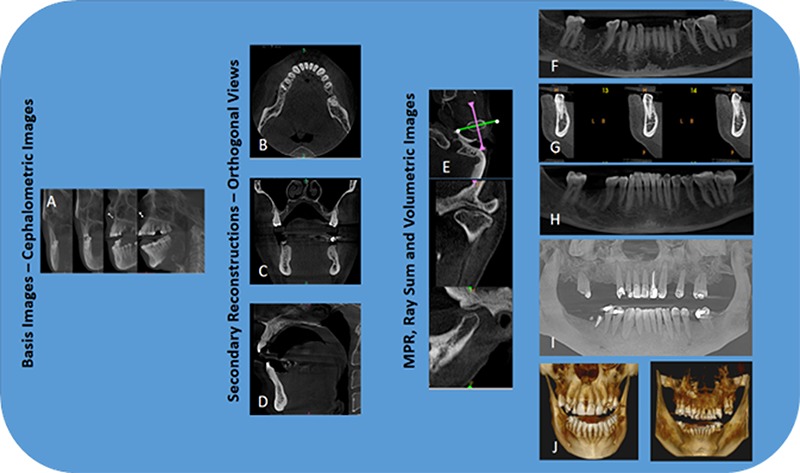 Cone beam computed tomography: basics and applications in dentistry.