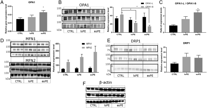 Alterations in antioxidant system, mitochondrial biogenesis and autophagy in preeclamptic myometrium