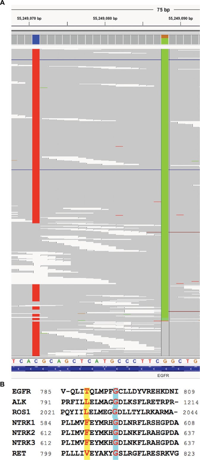 <i>Cis</i>-oriented solvent-front EGFR G796S mutation in tissue and ctDNA in a patient progressing on osimertinib: a case report and review of the literature.