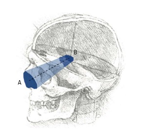 Quantitative comparison of cranial approaches in the anatomy laboratory: A neuronavigation based research method.