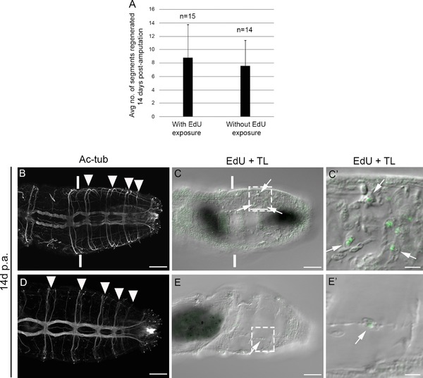 Investigation into the cellular origins of posterior regeneration in the annelid <i>Capitella teleta</i>.