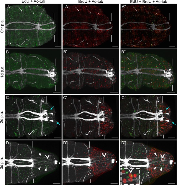 Investigation into the cellular origins of posterior regeneration in the annelid <i>Capitella teleta</i>.