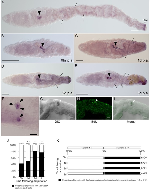 Investigation into the cellular origins of posterior regeneration in the annelid <i>Capitella teleta</i>.