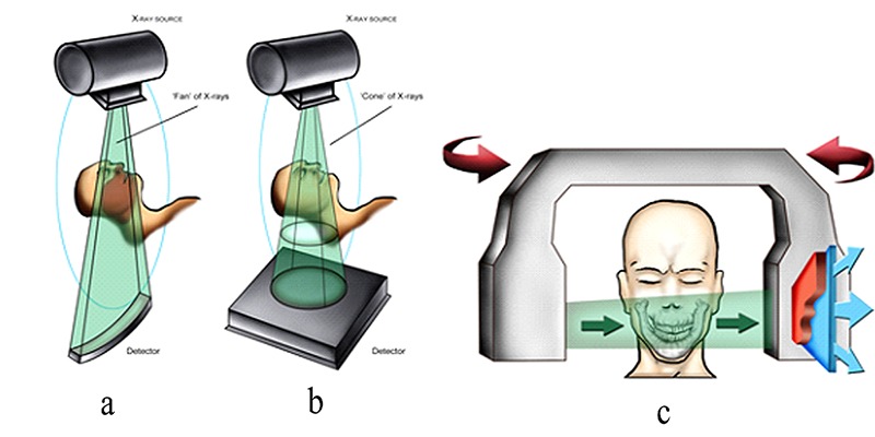 Advanced dental implant placement techniques.