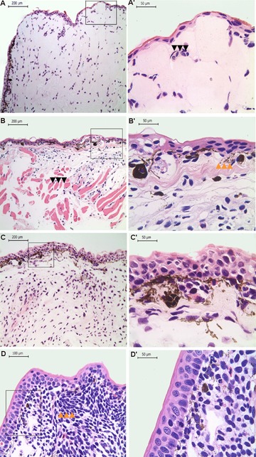 Limb regeneration in a direct-developing terrestrial salamander, <i>Bolitoglossa ramosi</i> (Caudata: Plethodontidae): Limb regeneration in plethodontid salamanders.