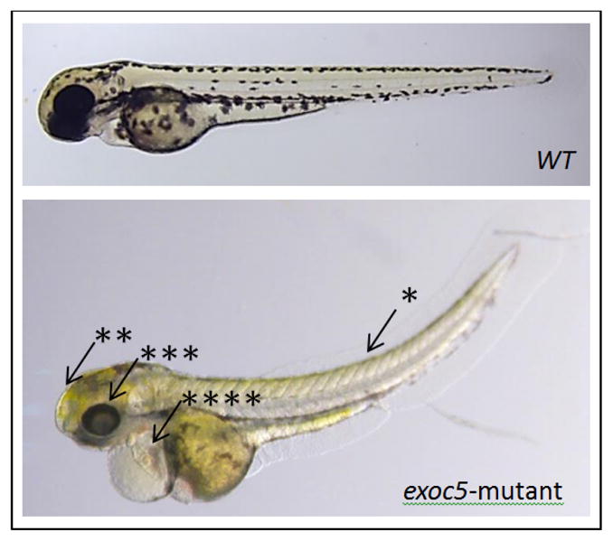 Zebrafish as models to study ciliopathies of the eye and kidney.