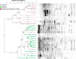 Gut microbiota diversity and T1DM onset: Preliminary data of a case-control study