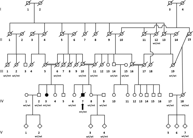 Pure Cerebellar Ataxia with Homozygous Mutations in the PNPLA6 Gene.