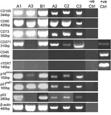 Variation in human dental pulp stem cell ageing profiles reflect contrasting proliferative and regenerative capabilities.