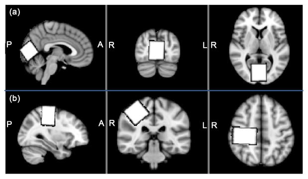 Voxel Placement Precision for GABA-Edited Magnetic Resonance Spectroscopy.
