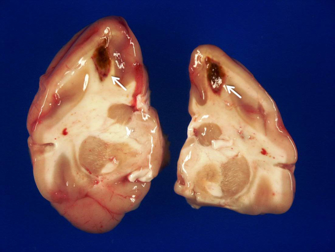 Intravascular T-cell lymphoma in a patas monkey (<i>Erythrocebus patas</i>).