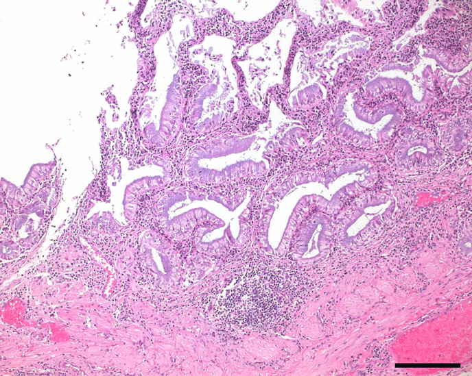 A case of gallstones in an African green monkey (<i>Chlorocebus aethiops</i>).