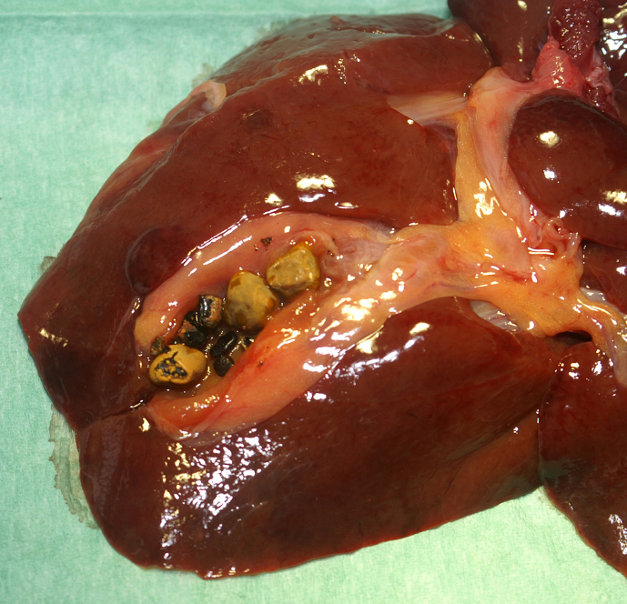 A case of gallstones in an African green monkey (<i>Chlorocebus aethiops</i>).