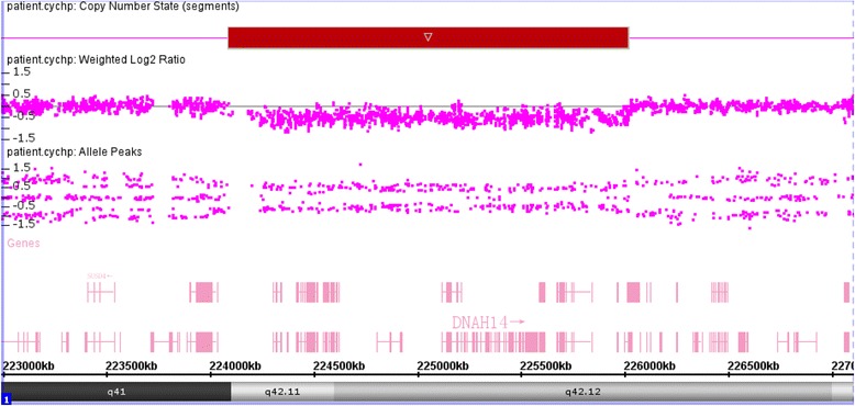 Psychomotor retardation with a 1q42.11-q42.12 deletion.