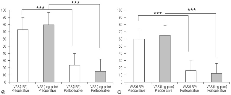 Assessment of Clinical Symptoms in Lumbar Foraminal Stenosis Using the Japanese Orthopaedic Association Back Pain Evaluation Questionnaire.